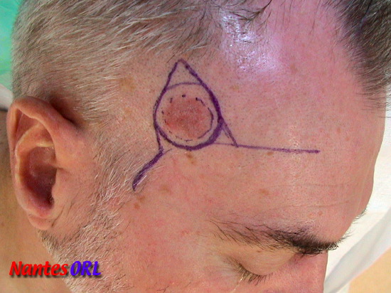 dessin2