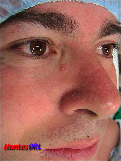 lesion.jpg