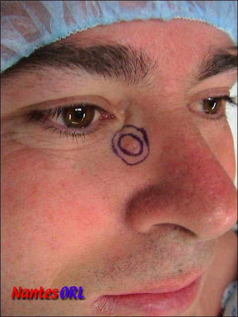 pds2.jpg