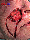 dissection