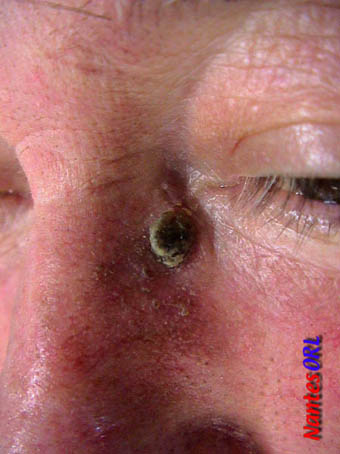 dsc00495