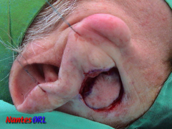 dsc00091