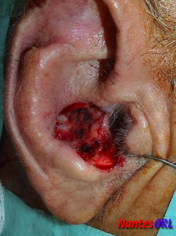 dsc01066