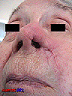 3mois