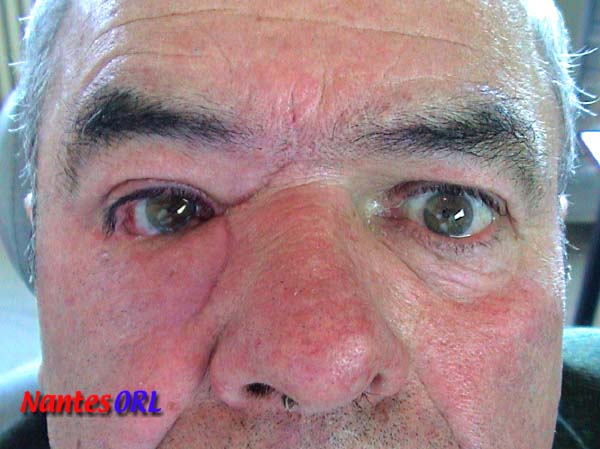 dsc00264