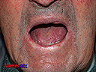 1an