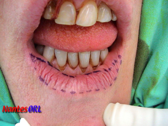 dsc00202