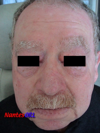 2mois.jpg