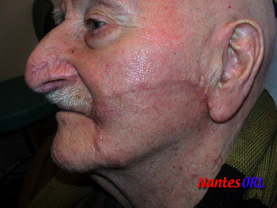 dsc01263